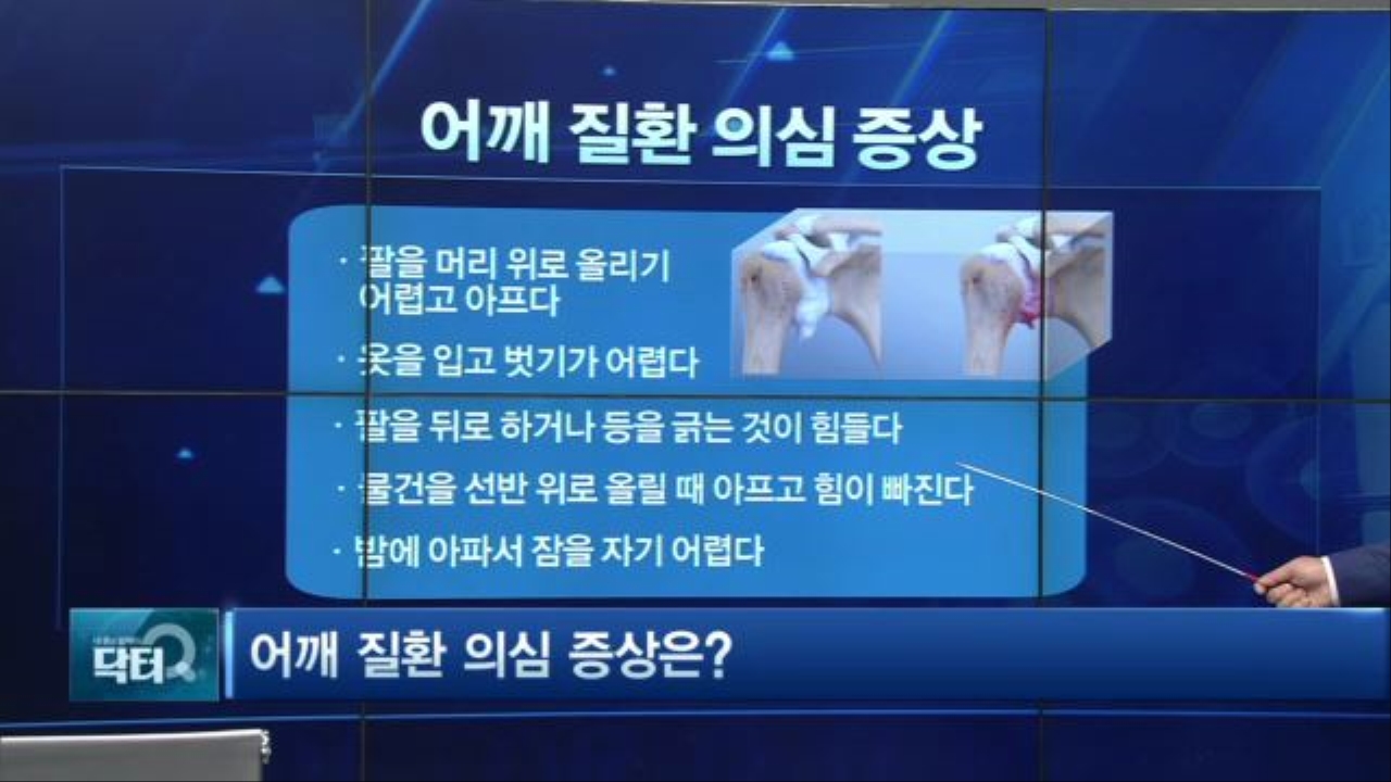 [3부] 중장년층 괴롭히는 어깨 통증 썸네일