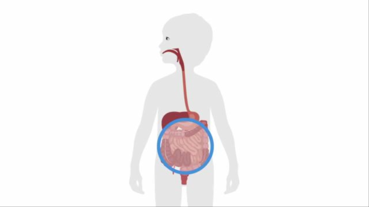 [헬스토픽] 단순 복통으로 오인하기 쉬운 '염증성 장질환' 썸네일