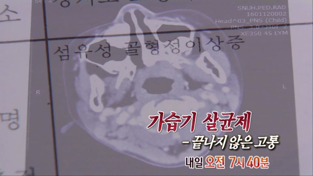 [4월 6일 예고] 가습기 살균제 - 끝나지 않은 고통 썸네일