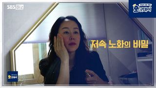 저속노화의 비밀