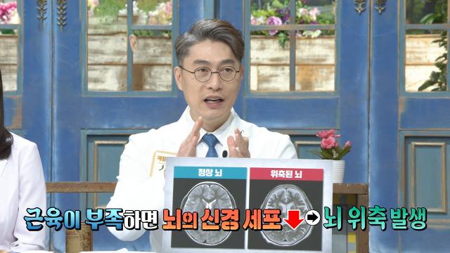 근육 부족과 치매의 연관 관계! (황금 장바구니) 썸네일