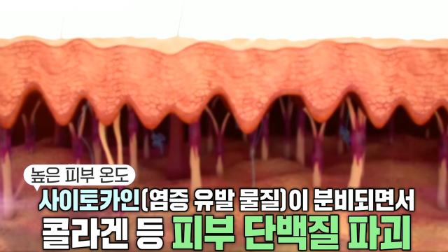 열 노화 부추기는 일상 속 생활 습관!