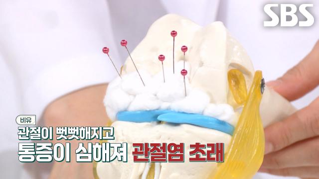 좀비세포, 관절 건강에 미치는 치명적인 영향! (닥터필생기)