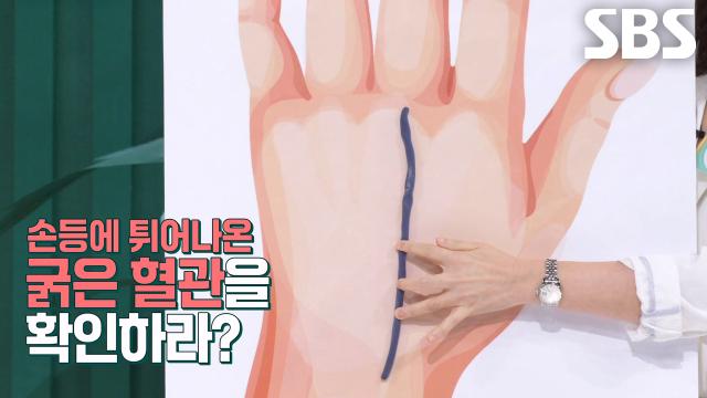 손등 혈관으로 건강 나이 확인하는 방법! (닥터필생기)