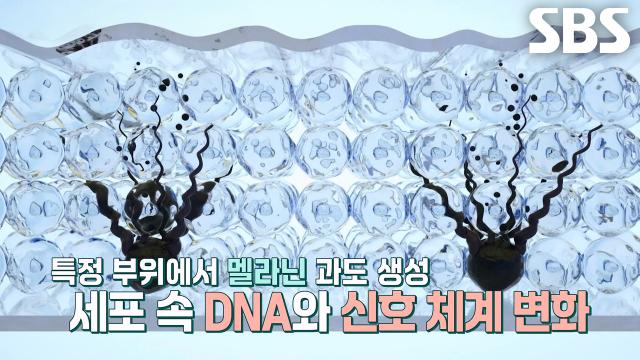 한 번 생긴 '기미', 뇌가 기억하는 이유! (똑똑똑!고민상담소)