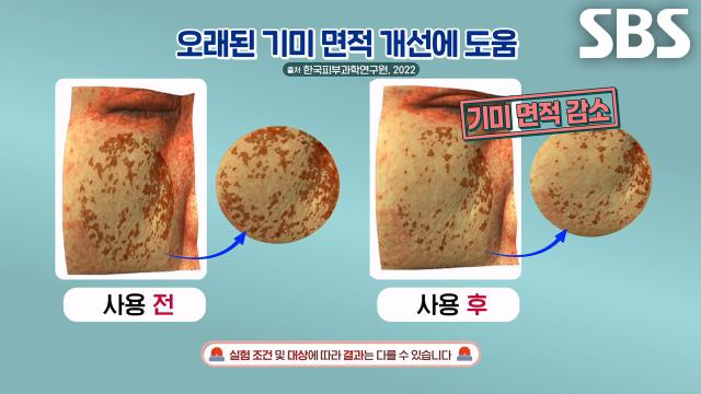 '매스틱', 피부 탄력 개선과 속기미 제거 돕는 효능! (똑똑똑!고민상담소)