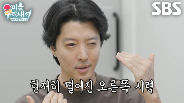 “빛을 보는 게 고통스럽다” 이동건, 1년 이상 지속된 '포도막염' 증상 썸네일