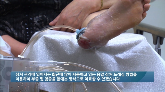 당뇨족 발생 원인과 예방법은?