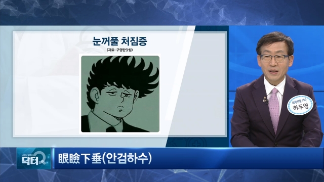 졸려 보이는 눈 '안검하수'