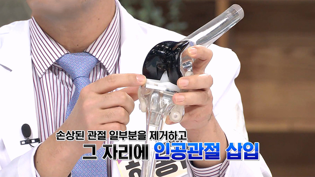좋은아침 N내 몸 주치의