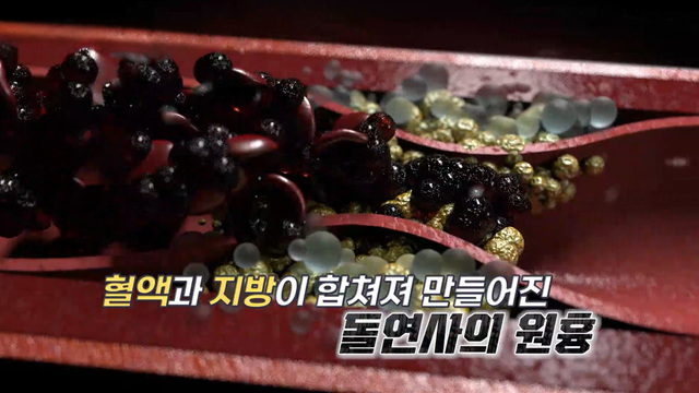 15회 60대 남편의 30년 순애보 썸네일