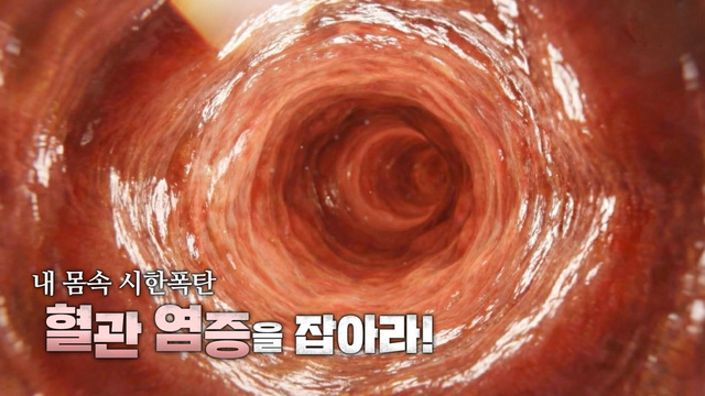 391회 내 몸속 시한폭탄 혈관 염증을 잡아라! 썸네일