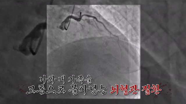  미켈란젤로가 찾은 뇌의 신비  34