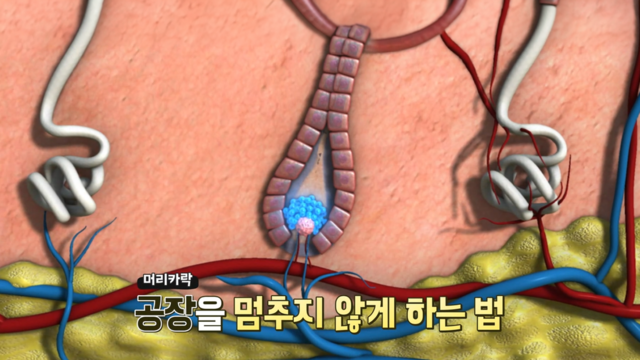 잠든 모발을 깨우다, 케라넷 2