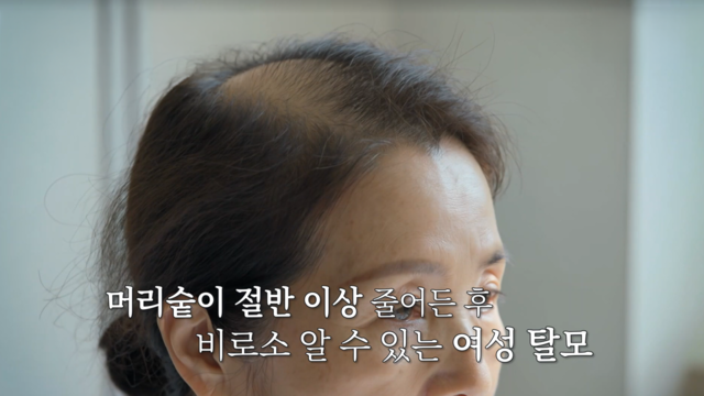 케라넷 편 9