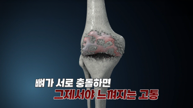 10회 콘드로이친 편 썸네일