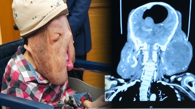 수술을 앞둔 현희씨 ‘5만명이 넘는 사람들의 후원금’