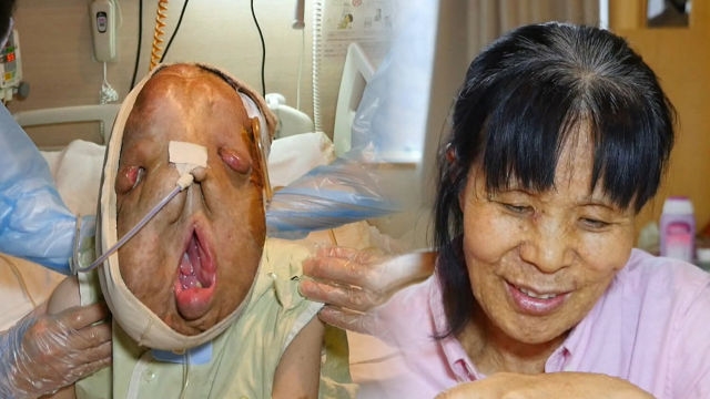 수술 이후 기적에 가까워지는 현희씨 ‘어머니도 수술’
