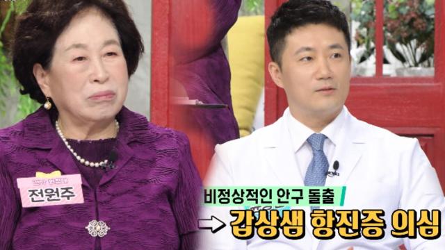 안구 돌출, 감상샘 항진증 의심해야 하는 이유! (닥터의선물)