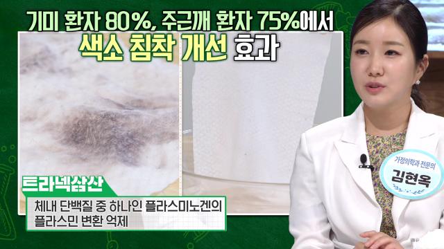 기미 개선 돕고 멜라닌 색소 억제하는 ‘트라넥삼산’ (더건강한스쿨)